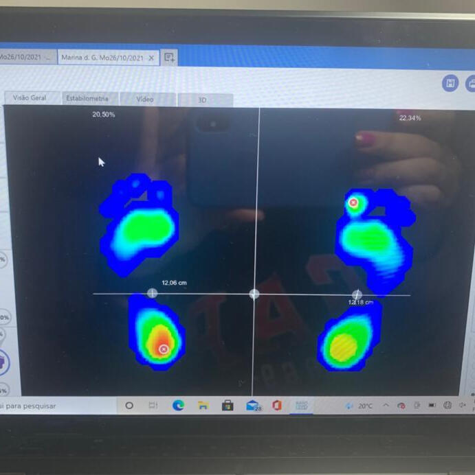 Instituto de Fisioterapia Hellen Caroline no Brooklin zona sul de São Paulo Instituto de Fisioterapia Hellen Caroline pilates, fisioterapia, RPG, palmilhas, massagem, drenagem linfática, liberação miofascial, acupuntura, ventosaterapia, disfução ATM no Brooklin zona sul de São Paulo